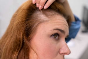 Dealing with Hair Thinning? Explore the Best Hair Loss Solutions Near Me