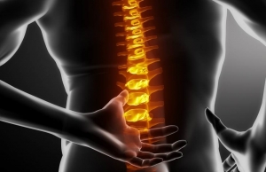 Spinal Stenosis: Causes, Symptoms, and Modern Treatment Options