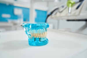 What Foods Should Be Avoided After All-on-4 Dental Implant Surgery?