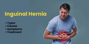 Inguinal Hernia: Types, Causes, Symptoms & Treatment