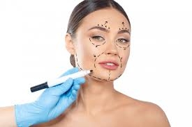 Top Benefits of Thread Lift in Islamabad