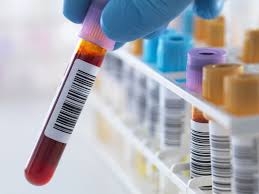 Understanding HLA Testing Cost for Organ Transplants and Bone Marrow Matching