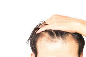 How FUE Hair Transplant Boosts Confidence and Looks
