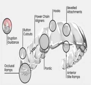 Precision Orthodontics: The Path to a Confident Smile