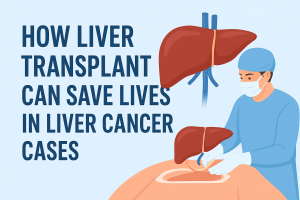 How Liver Transplant Can Save Lives in Liver Cancer Cases