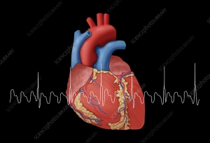 Atrial fibrillation (Afib) market scope, technological innovations, patient demographics, and industry challenges