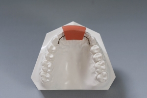 What Is Dental Putty and What Is It Used For?