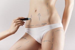 Step Boldly Into Your Sleek Era With Liposuction in Dubai Magic