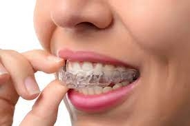Dental Appliances vs. Braces: What’s the Difference?