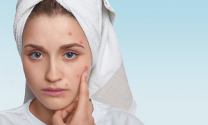 Skin Treatment Costs for Pigmentation and Dark Spots