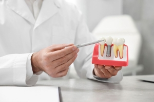 Everyday Glow Shines Brighter Than Ever With Dental Implants Dubai
