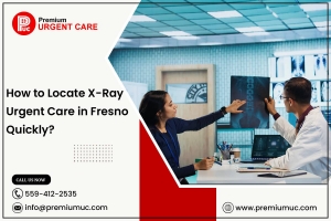 How to Locate X-Ray Urgent Care in Fresno Quickly?