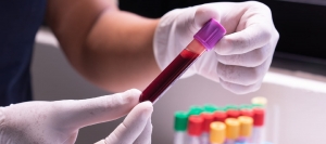 Why Checking in with a CBC Test is the Health Reset We All Need