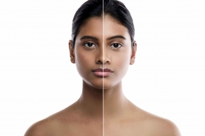 Unlock a Radiant Glow Journey via Advanced Skin Whitening Treatment Cost