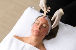 Beauty Begins with Chemical Peel in Dubai