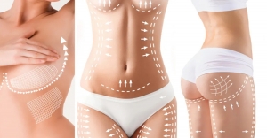 How to Self-Massage After Liposuction: The Secret to Smooth Results