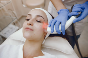 Best Clinics for Laser Pigmentation Removal in Birmingham