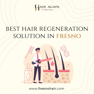 Hair Regeneration Treatment in Fresno CA: Restoring Confidence Through Advanced Solutions
