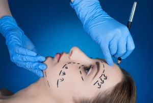 Facelift