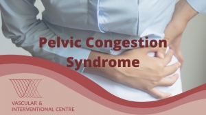 Pelvic Congestion Syndrome Treatment Options Available in Albuquerque