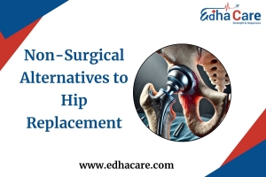 Non-Surgical Alternatives to Hip Replacement: Exploring Effective Options inIndia