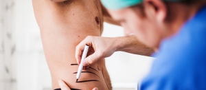 Liposuction Cost in Dubai Shapes Confidence Beyond Expectations