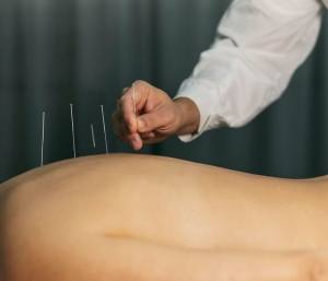 Dry Needling Pakenham