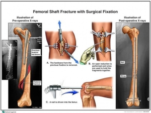 Dr. Mohanty Orthopaedics: Advanced Joint Care You Trust