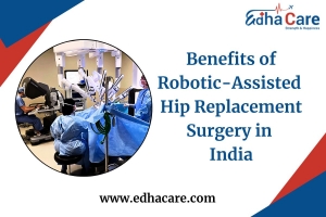 Robotic Hip Replacement in India: Benefits with EdhaCare