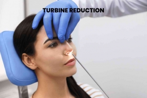 What Is Turbinate Reduction? Procedure, Recovery, and Results