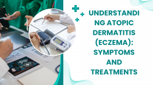 Understanding Atopic Dermatitis (Eczema): Symptoms and Treatments