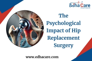 Psychological Impact of Hip Replacement in India with EdhaCare