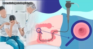 Common Fears & Concerns Regarding Colonoscopy