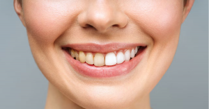 What Are the Most Common Causes of Tooth Discolouration?