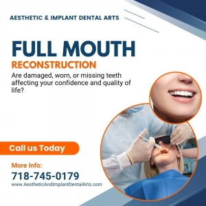 What is the Process for Getting Full Mouth Dental Implants in Brooklyn, NY?