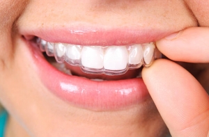 The Clear Path to a Straighter Smile: Exploring Invisalign Options in Louisville CO