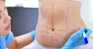 The Emotional Journey: What to Expect Post Lipo Abdominoplasty