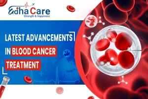 Blood Cancer Treatment: Embracing the Latest Advancements