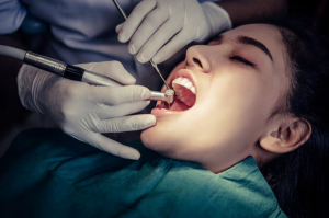 What Periodontists Do and Why You Might Need One