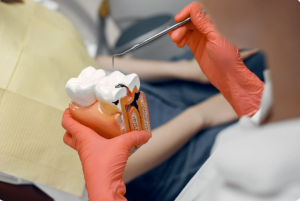 Why Choose Our Teeth Filling Dental Clinic in Vikaspuri?