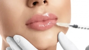 Understanding Modern Lip Filler Techniques in Islamabad
