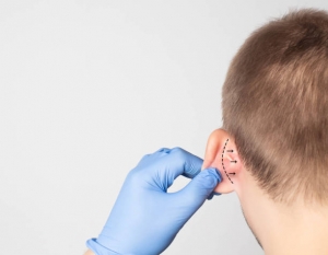 How to Manage Pain and Swelling After Ear Reshaping Surgery