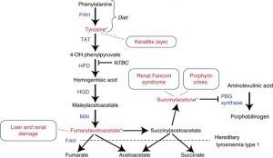 How Tyrosinemia Affects the Body: A Deep Dive into the Metabolic Disorder