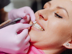 How a Dentist Can Transform Your Smile with Veneers