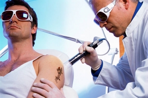 Laser Tattoo Removal in Dubai – A Complete Guide