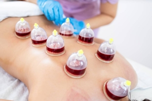 Realign Naturally Using Hijama Treatment Cost Dubai Today