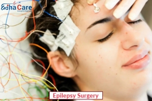 Epilepsy Treatment in India – Advanced Care with EdhaCare