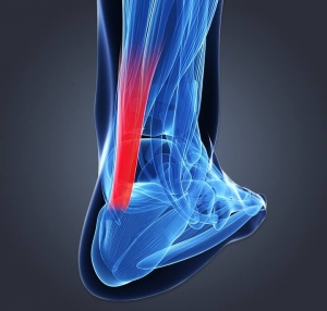 Expert Care and Achilles Tendon Surgery in Houston