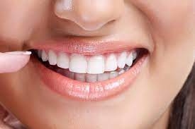 What Are the Risks of Gum Contouring?