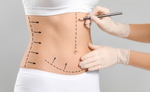 Power-Assisted Liposuction: Is it Better Than Traditional?